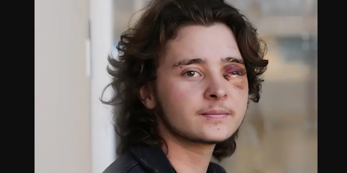 Kaden Rummler GoFundMe: 21-Year-Old Blinded by Federal Agent During ...