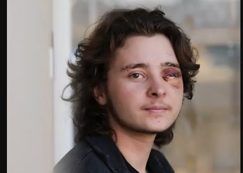 Kaden Rummler GoFundMe: 21-Year-Old Blinded by Federal Agent During Protest